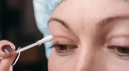 Blepharoplasty-aftercare.webp