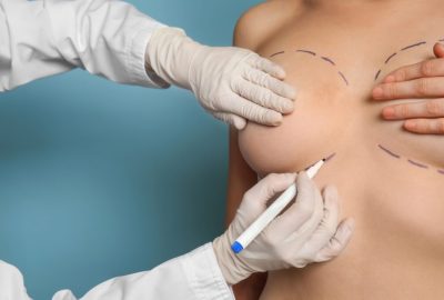 breast-augmentation (2)