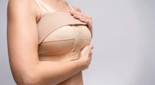 breast-augmentation (4)