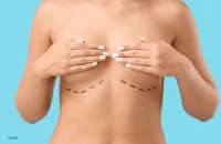 breast-augmentation (6)