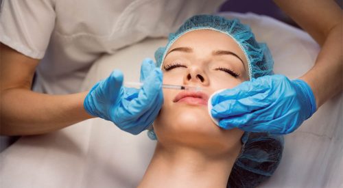 lip lift surgery (2)