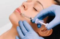 lip lift surgery (4)
