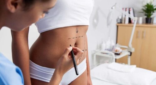 liposuction-consultation2.jpg