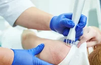 scar removal (3)