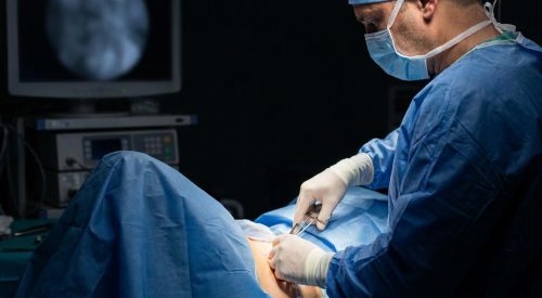 surgery